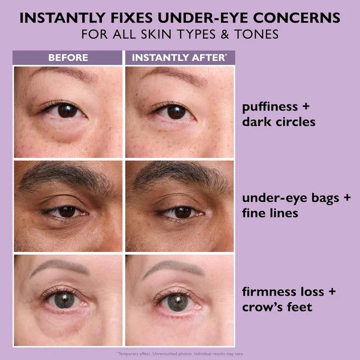 Instant FIRMx® Eye Temporary Eye Tightener Easy-Wear Formula | For Firming Under-Eye Bags & Wrinkles