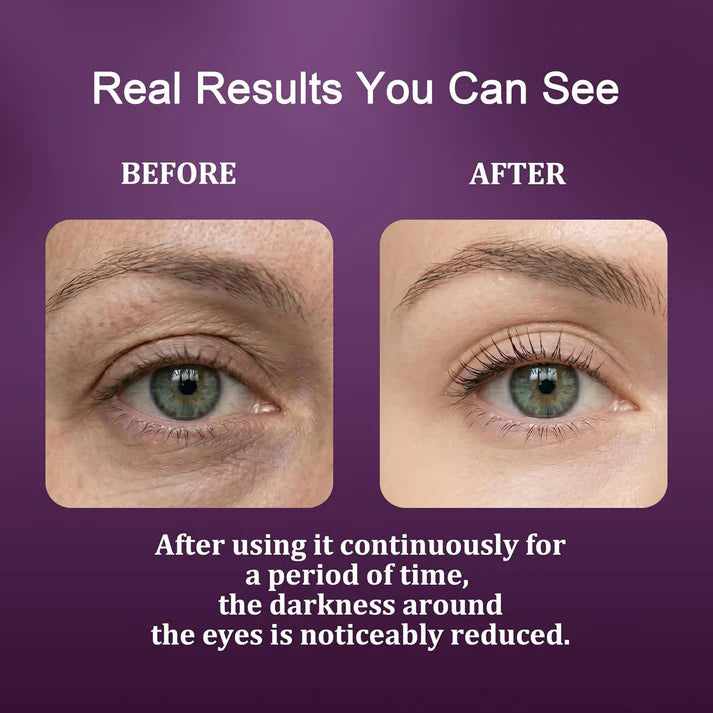 Calcium Dark Spot Eye Cream 2 Pack | Anti-Aging Eye Cream for Dark Circles