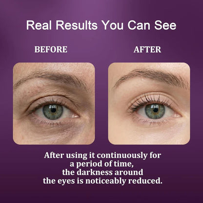 Calcium Dark Spot Eye Cream 2 Pack | Anti-Aging Eye Cream for Dark Circles
