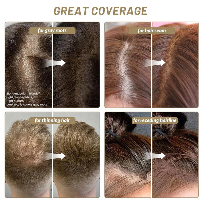 Gray Hair Concealer for Men and Women, Instantly Covers Thinning Hair and Bald Spots