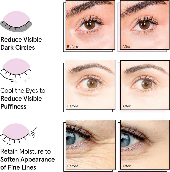 Grace & stella Award Winning Under Eye Mask - Reduce Dark Circles, Puffy Eyes