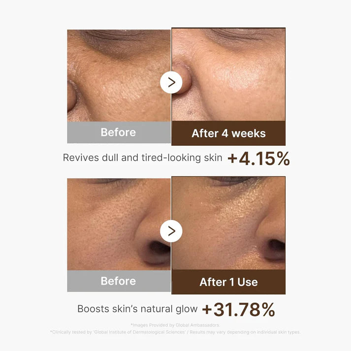 Medicube Deep Vitamin C Capsule Serum | Hydrating Vitamin C Serum for Dull & Uneven-Looking Skin