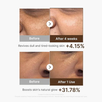 Medicube Deep Vitamin C Capsule Serum | Hydrating Vitamin C Serum for Dull & Uneven-Looking Skin