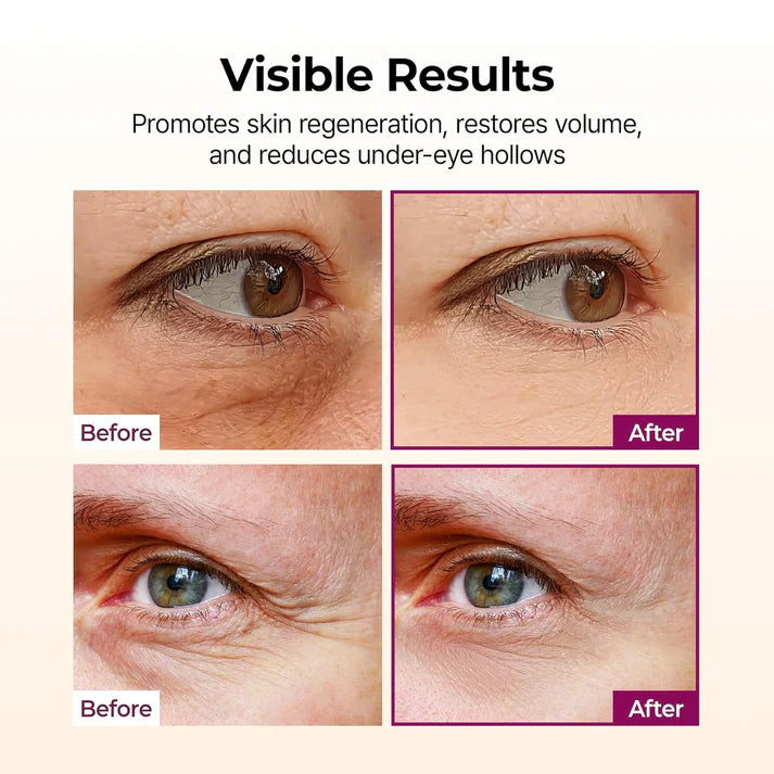 Dr.Melaxin Collagen Multi Balm Stick, Calcium & Adenosine Wrinkle Stick for Eye Neck & Face