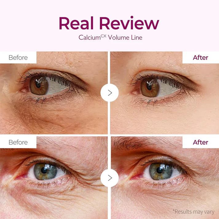 Dr.Melaxin Cemenrete Calcium Volume Eye Patch for Sagging Under Eye Skin, Eye Mask Care for Wrinkles (60Patches)