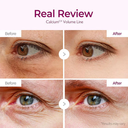 Dr.Melaxin Cemenrete Calcium Volume Eye Patch for Sagging Under Eye Skin, Eye Mask Care for Wrinkles (60Patches)