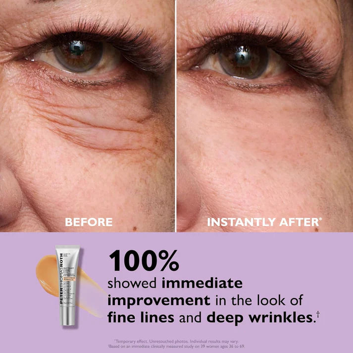 Instant FIRMx® Eye Temporary Eye Tightener Easy-Wear Formula | For Firming Under-Eye Bags & Wrinkles